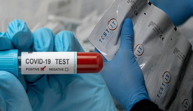 Pandeminin yıldız firması konkordato ilan etti! 3 ay süre tanındı