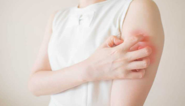 Sivrisinek ısırığı ile gelen ölümcül tehlike! Uzmanlardan hayat kurtaran öneriler