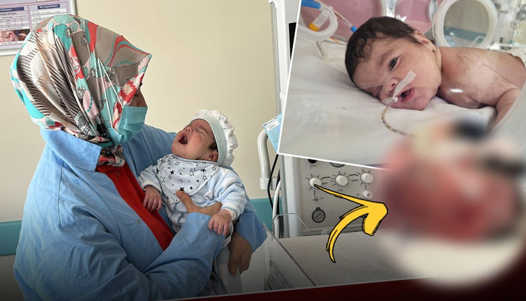 Dünyada yedinci vaka: 34 haftalık bebeğin boynundan çıkan şoke etti!