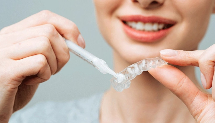 Diş beyazlatmayla ilgili doğru bilinen 5 yanlış!