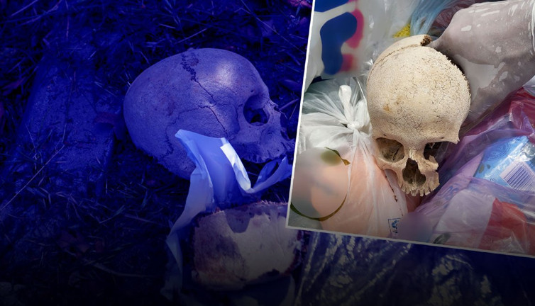 Adana'da tüyler ürperten olay! Çöpten çocuk kafatası çıktı