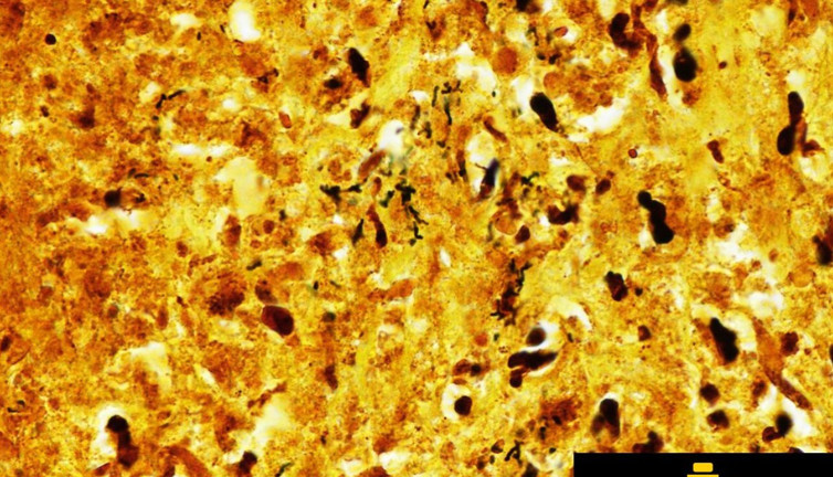 Uzayın esrarengiz misafiri bilim dünyasını hayrete düşürdü