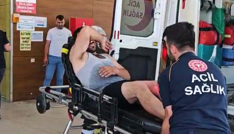 Oto tamircisinde korku dolu anları! Kaynar su felaketini yaşadı