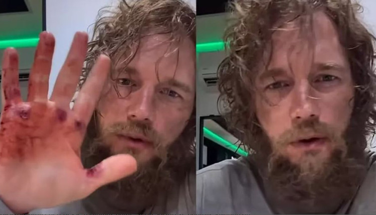 'Galaksinin Koruyucuları’nın yıldızı Chris Pratt tanınmaz halde! Yeni görünümü hayranlarını şaşkına çevirdi