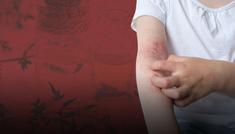 Asırlık reçete Güneydoğu’dan çıktı! Mantar ve egzamaya doğal darbe