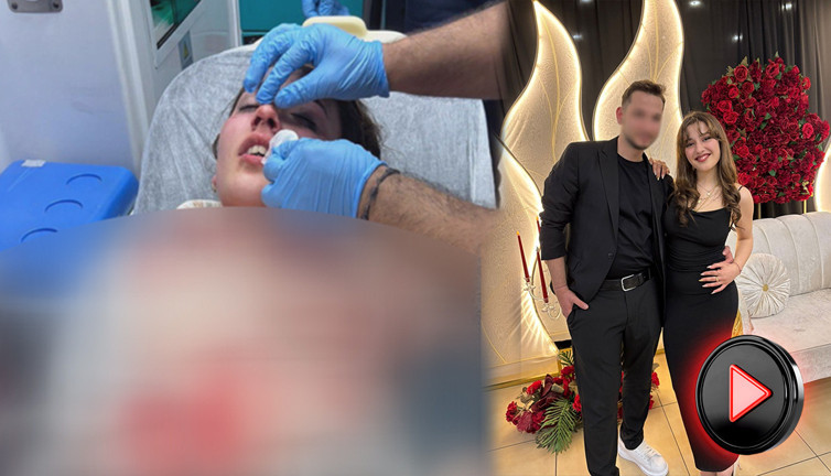 Nişanlısının burnunu kafasıyla kırıp kaçtı! 20 yaşındaki genç kız şikayetçi oldu