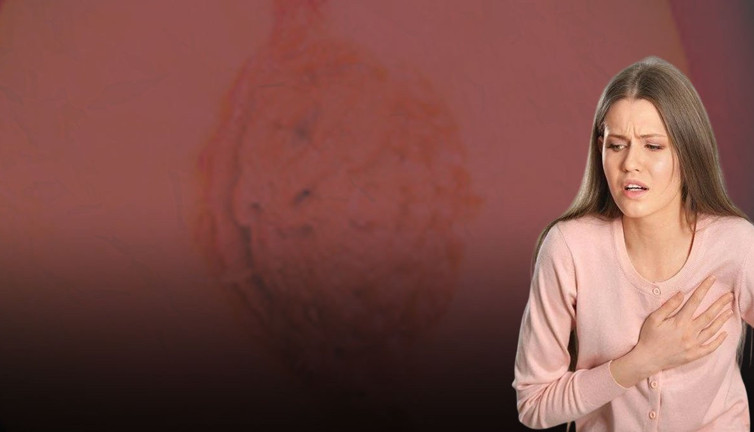 Kalp meyvesi, damarları adeta bir stent gibi açıyor! Mucize, damar tıkanıklığına doğal çözüm oluyor