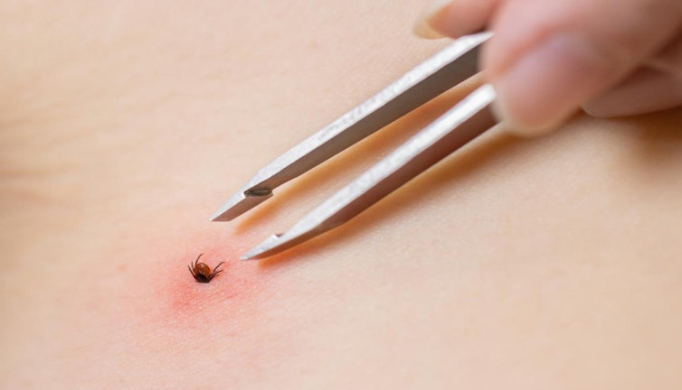 Kene ısırığı ölüm getirdi: Trabzon'da çoban öldü!