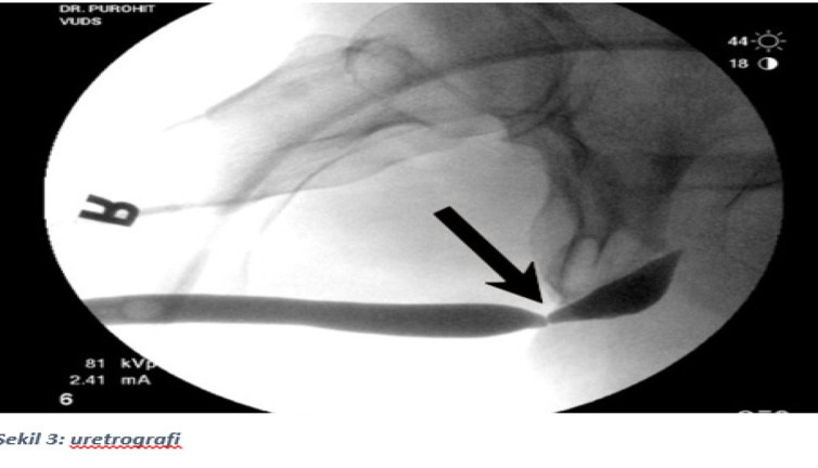 Yanlış müdahale kronik probleme çeviriyor! Uzmanlar uyardı