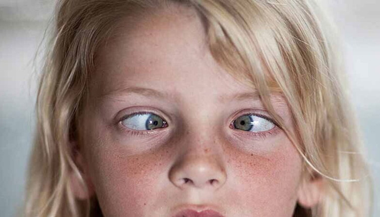 Çocuklarda şaşılığın görünmeyen yüzü! İşin uzmanlar anlattı