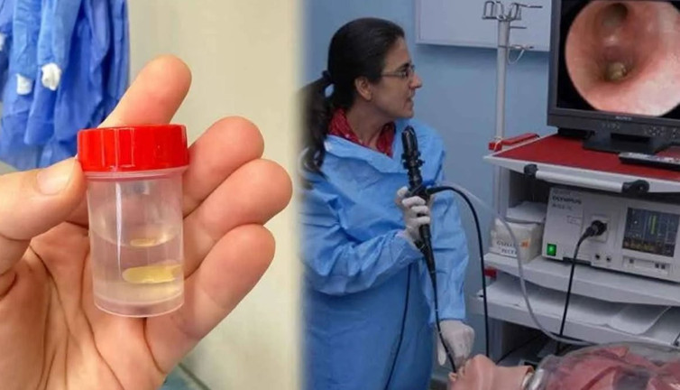 Denizli’de inanılmaz olay! Akciğer enfeksiyonu sandılar: Gerçek 5 ay sonra ortaya çıktı