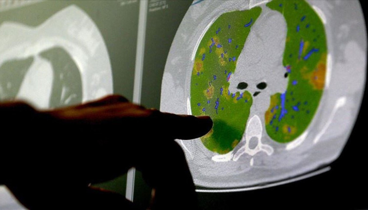 Pandemi beyinleri nasıl etkiledi? Şok edici araştırma sonuçları! Uzmanlar tek tek anlattı