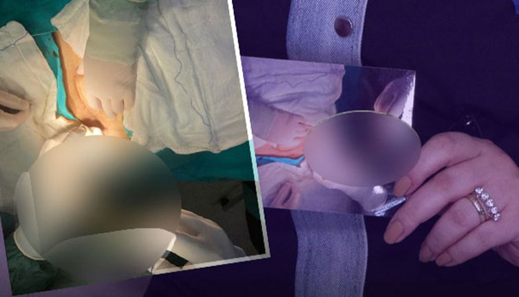 Doktordan skandal sözler! Sezaryen doğumla hayatı kabusa döndü!