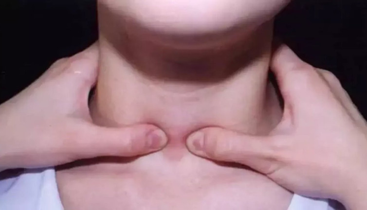 Boyundaki şişlik ne anlatıyor? Gizli tehlikeler ortaya çıktı