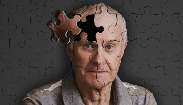 Alzheimer hastalığıyla ilgili uzmanlardan hayati öneriler