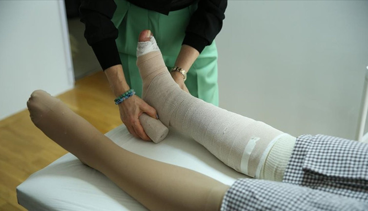 Yanlış sülük tedavisinin hayati tehlikeleri! Uzmanlardan kritik öneriler