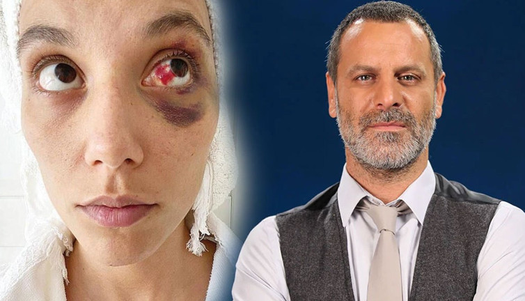 Taciz ifşaları sürerken topa tutulmuştu! Ozan Güven projeden apar topar ayrıldı