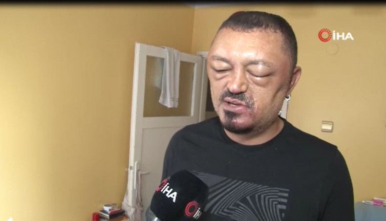 Şampuanı kafasına döktü hayatı kabusa döndü. Evinize bile sokmayın. 301 TL ödedi