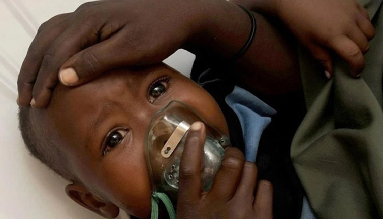 M çiçeği kabusu: Gana'da vakalar hızla artıyor!