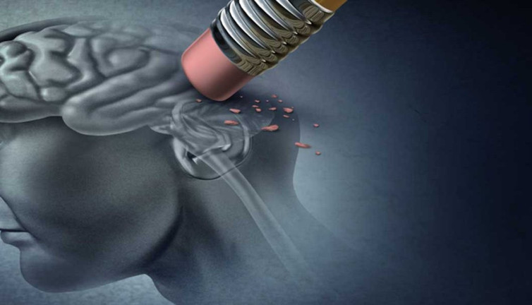 Beyni koruyan üç sihirli formül! Alzheimer’ı durduran bilimsel adımlar