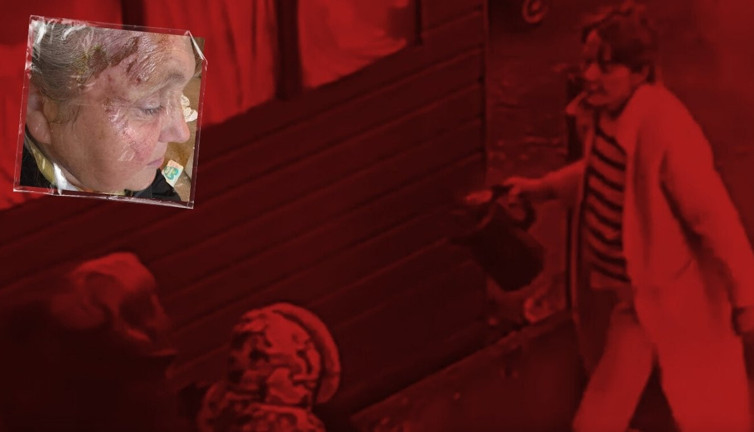 20 yıllık komşusu yaşlı kadına kaynar suyla saldırdı: Torunun gözleri önünde dehşeti yaşadı