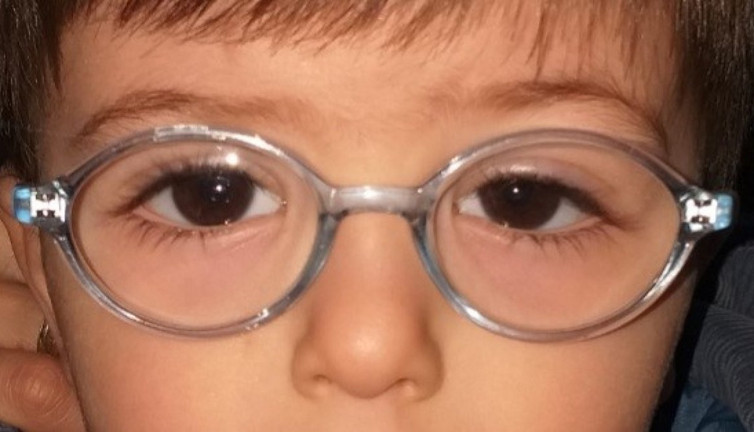 Göz tembelliği alarmı! Okul başarısını yıkıyor, erken teşhis kurtarıyor