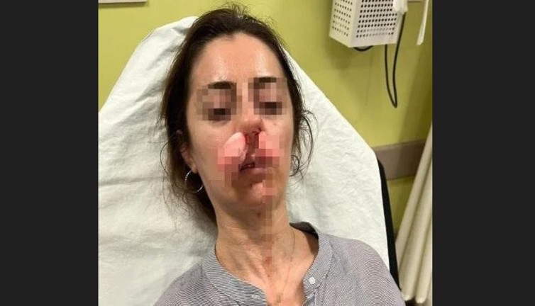 Otomobilin kapısı silah sayıldı. Kadın şimdi yandı