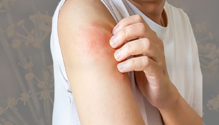 Bin yıllık şifalı ot mucize saçıyor! Anadolu'nun bereketli topraklarından fışkırıyor! İştah açıcı bitki egzamayı iyileştiriyor