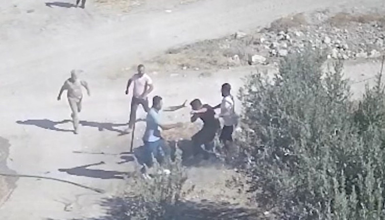 Kuzenlerin sondaj kavgası kanlı bitti