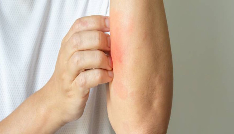 Yeni ve sinsi salgın tehdidi! Uzmanlar uyardı