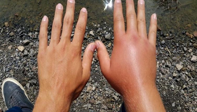 Sıradan bir sokma, ani tepki! Bilim insanlarından şok uyarı