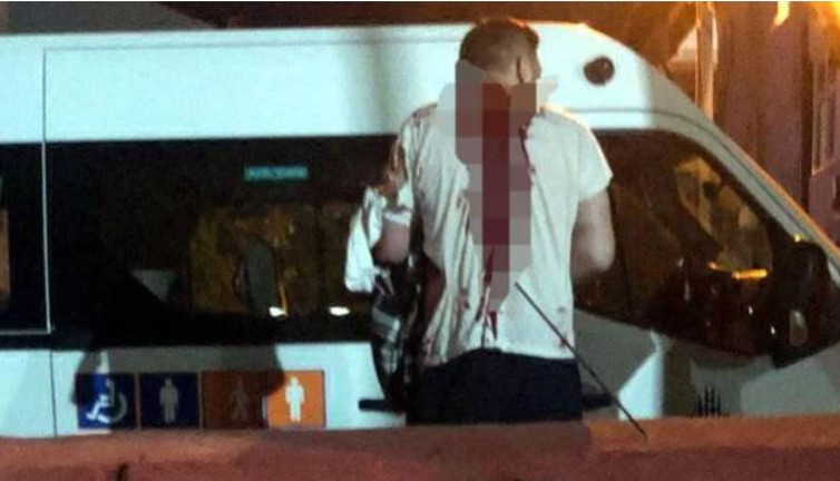 3 yıl önce zıpkınla vurdu şimdi kurşun yağdırdı