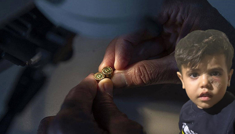 Oyun oynarken ölümle burun buruna! Gözünden vuruldu: Polis magandayı arıyor