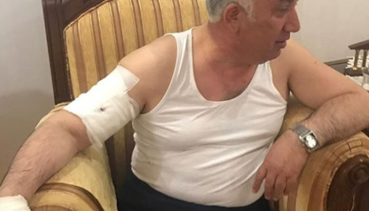 Belediye Başkanı'na yardım götürdüğü evde köpek saldırdı