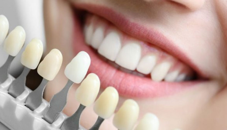 Dişlerdeki renk değişimi hangi sebeplere bağlı?