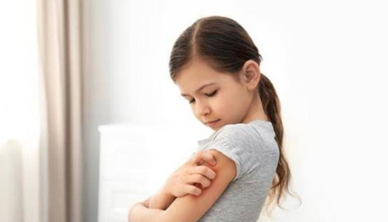 Çocuklarda cilt döküntülerine dikkat! Bulaşıcı olabilir