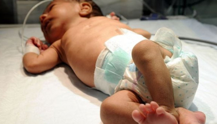 "Türkiye'de her yıl 15 bin bebek kalp hastalığıyla doğuyor"