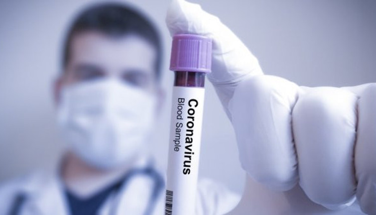 Komşuda ilk corona virüs ölümü!