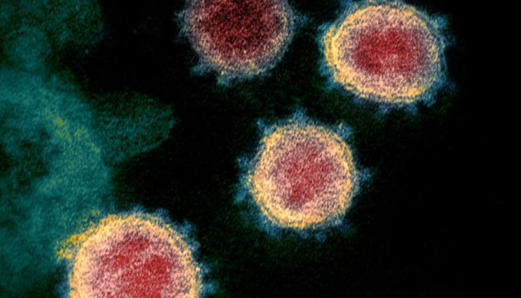 Çin'in kuzeydoğusunda ortaya çıktı! Covid-20 mi geliyor?