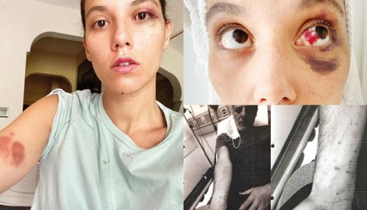 İşte Ozan Güven - Deniz Bulutsuz olayında ilk tanık ifadesi