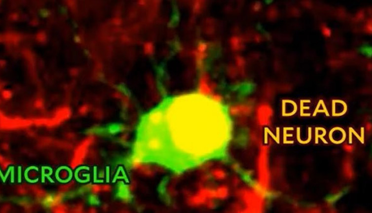 Bilim insanları ilk kez görüntüledi: Beyin kendini nasıl yeniliyor?