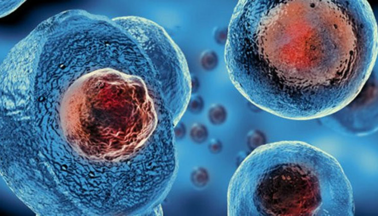 Kök hücre tedavisi nedir? Kök hücre tedavisi nasıl yapılır?