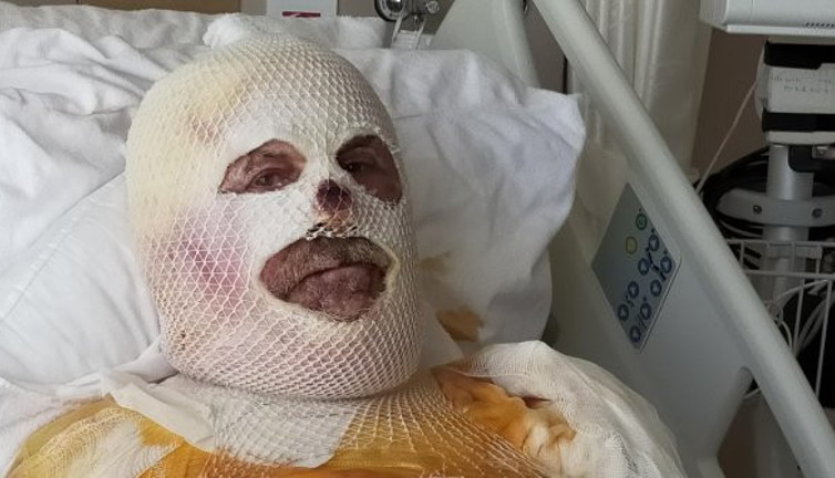 Çay keyfi 7 çocuk babasını bu hale soktu