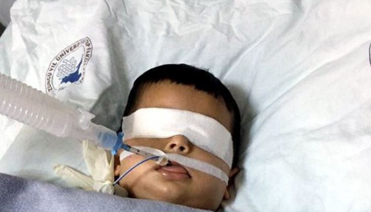 Nefes borusuna fasulye kaçtı yatalak kalacak