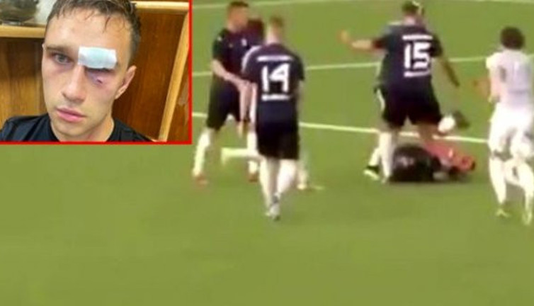 Rusya'da skandal olay! "Kart gösterirsen seni döverim" dediği hakemi hastanelik etti