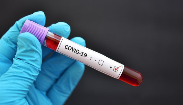 Hasta sayıları kırmızı alarm veriyordu: Pozitif vakalarla ilgili korkunç gerçek!