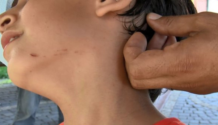 Torunu yaşındaki çocuğa pusu kurup suratını yırttı! İnsan demek için bin şahit lazım