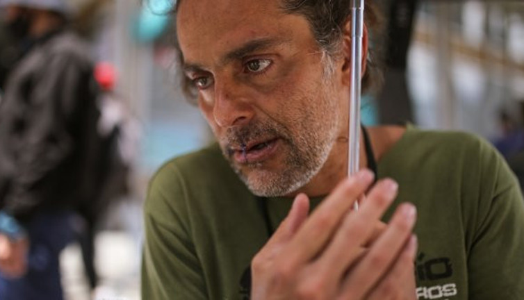 Dudaklarını dikti, sebebi ülkeyi karıştırdı