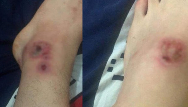 Asya Kaplanı paniği Türkiye'de büyüyor