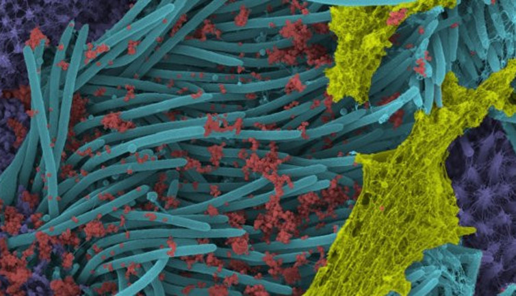 Korona solunum yoluna girip, hücreleri böyle ele geçiriyor… Her şey böyle başlıyor: Tıp dergisinde yayınlandı